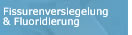 Fissurenversiegelung und Fluoridierung